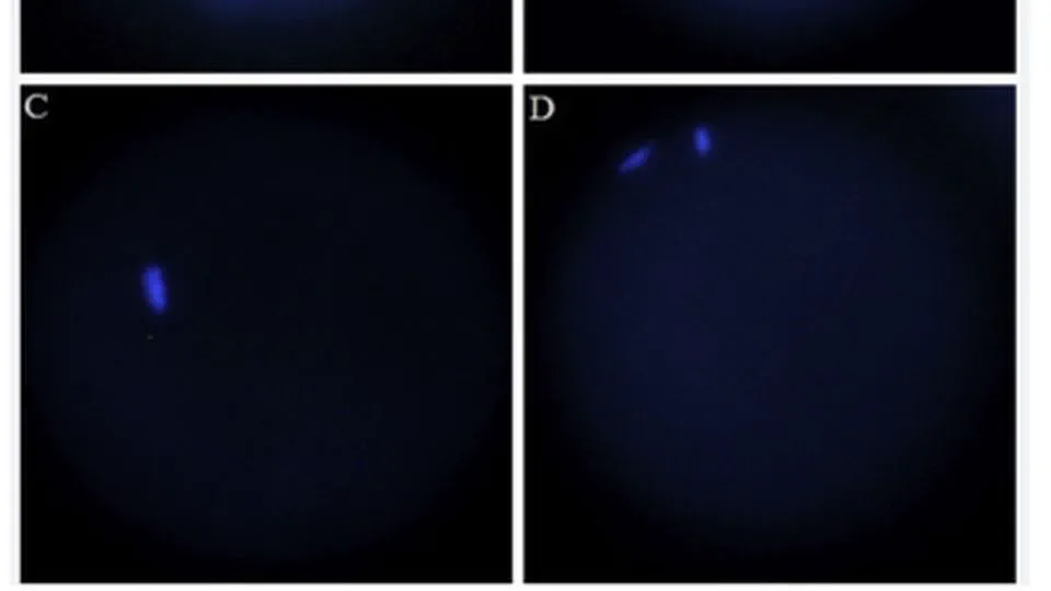 Transcriptional profile of ovine oocytes matured under lipopolysaccharide treatment in vitro